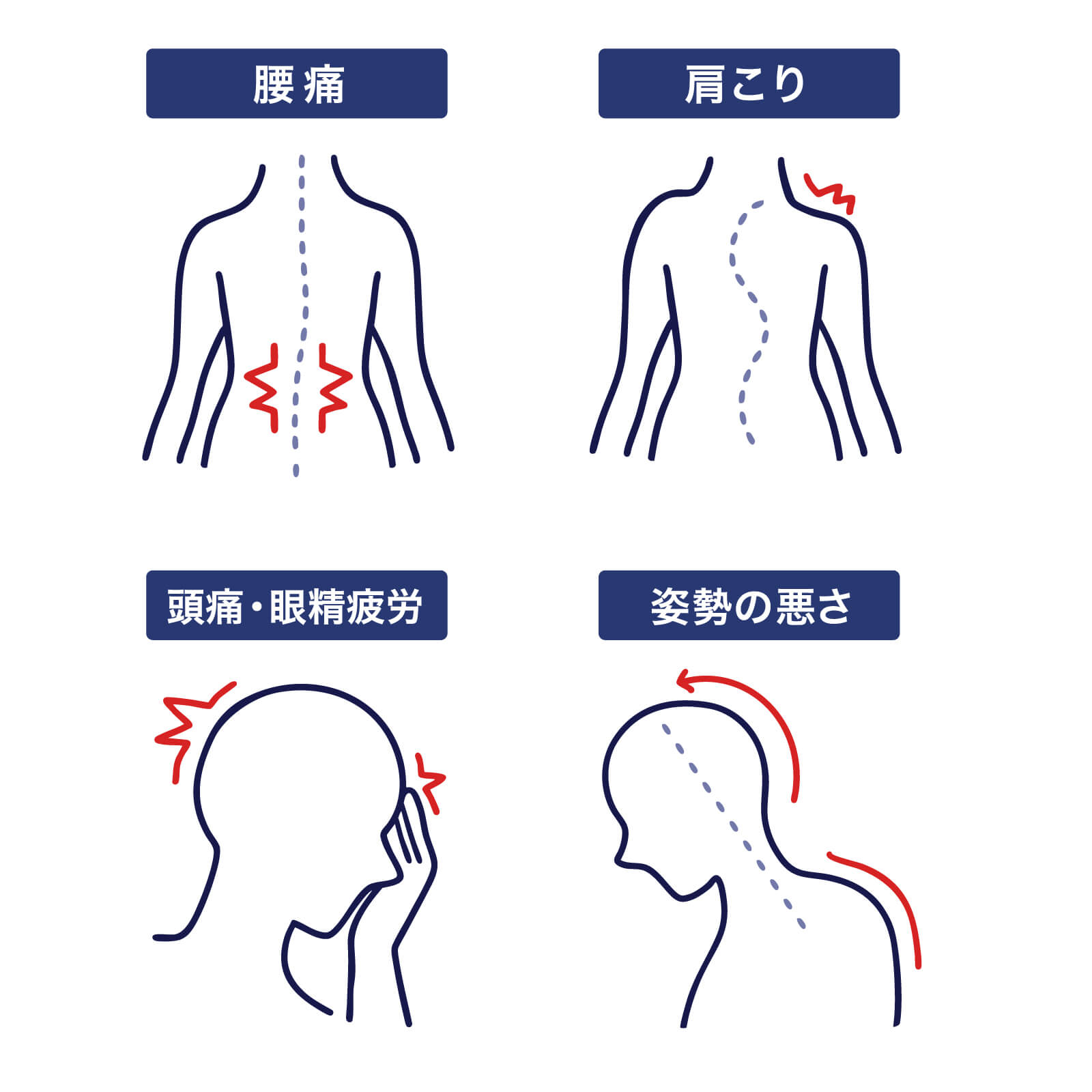 骨盤のゆがみが引き起こす悪影響